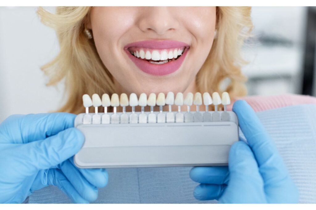 teeth whitening samples